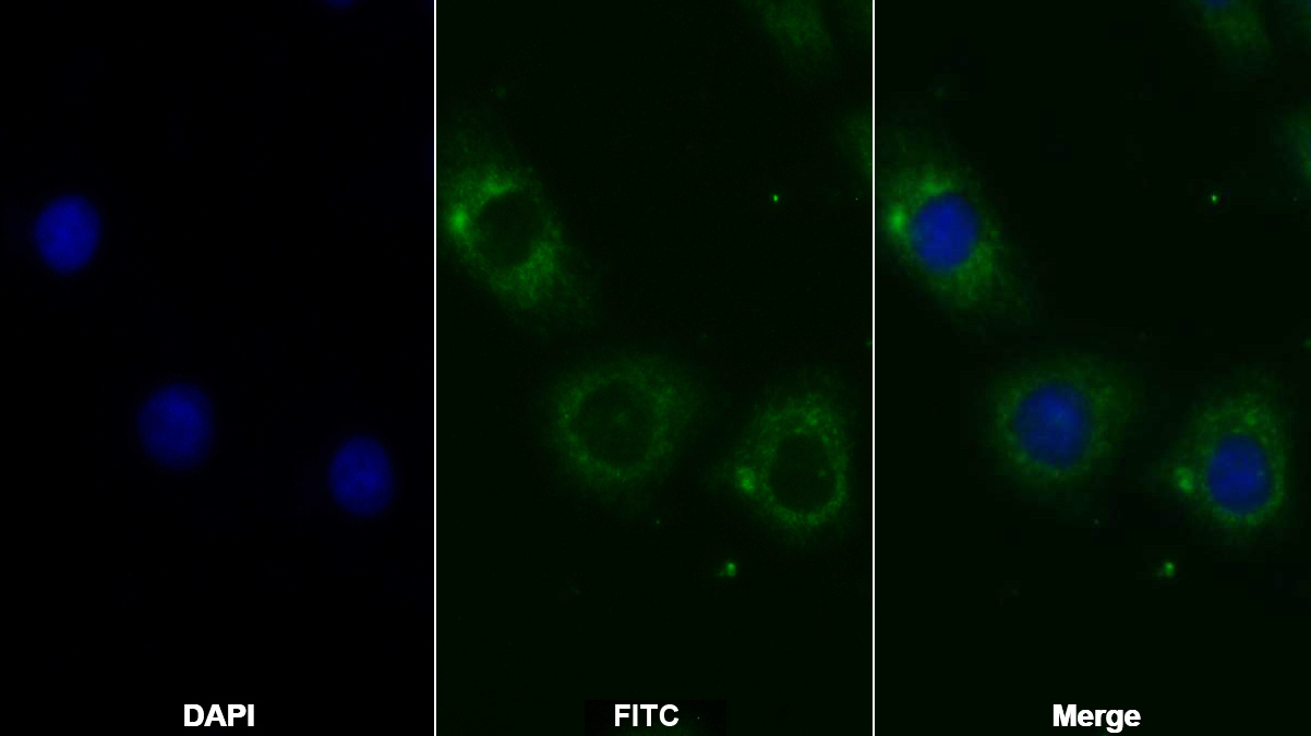 Polyclonal Antibody to Insulin Receptor (INSR)
