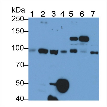 Polyclonal Antibody to Insulin Receptor (INSR)