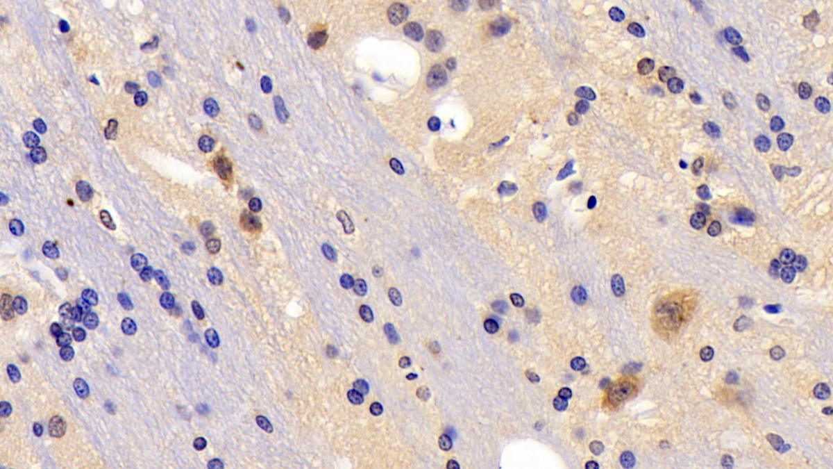 Polyclonal Antibody to Insulin Receptor (INSR)