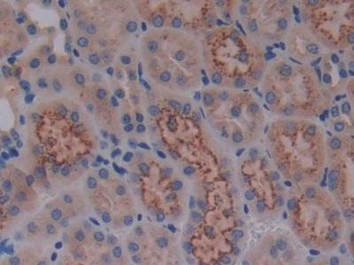 Polyclonal Antibody to Cystatin C (Cys-C)