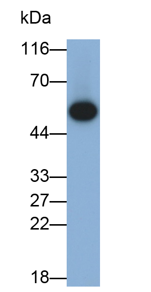 Polyclonal Antibody to Osteopontin (OPN)