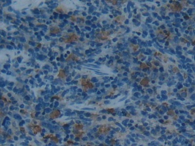 Polyclonal Antibody to Acid Phosphatase 5, Tartrate Resistant (ACP5)