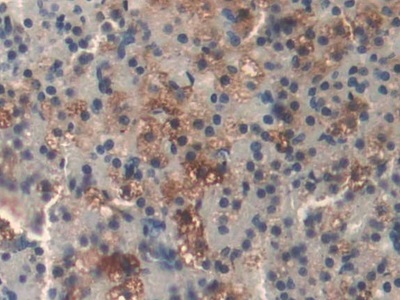 Polyclonal Antibody to Dihydrolipoyl Dehydrogenase (DLD)