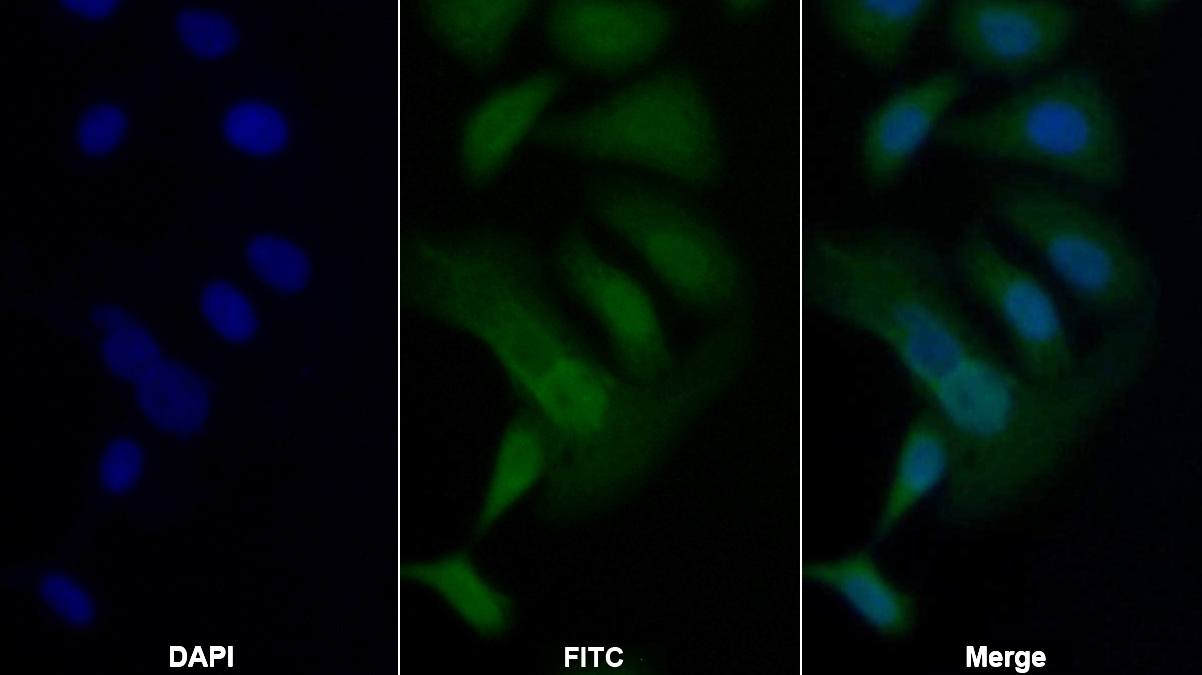 Polyclonal Antibody to Tumor Protein p53 (P53)
