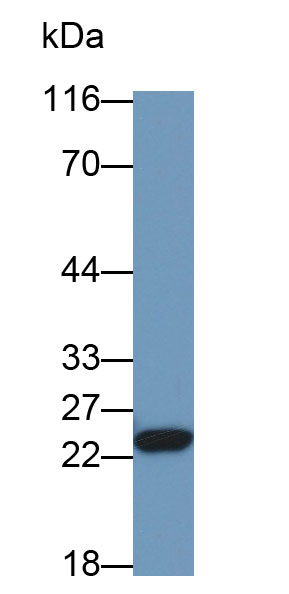 Polyclonal Antibody to Retinol Binding Protein 4 (RBP4)