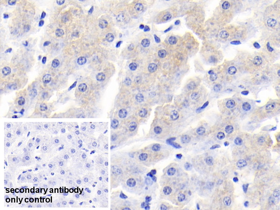 Polyclonal Antibody to Retinol Binding Protein 4 (RBP4)