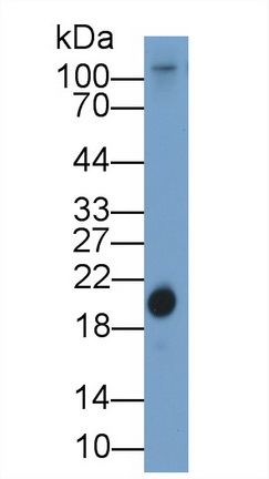 Polyclonal Antibody to Retinol Binding Protein 4 (RBP4)