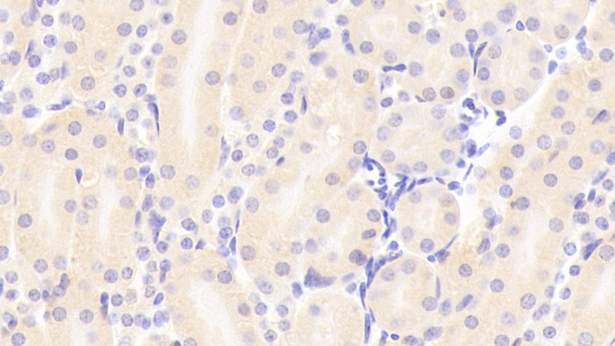 Polyclonal Antibody to Retinol Binding Protein 4 (RBP4)