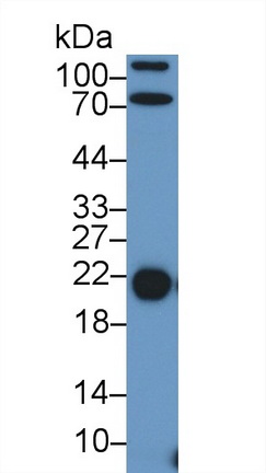 Polyclonal Antibody to Retinol Binding Protein 4 (RBP4)