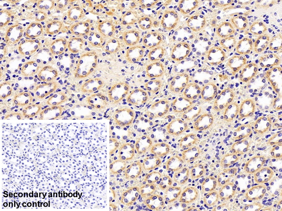 Polyclonal Antibody to Retinol Binding Protein 4 (RBP4)