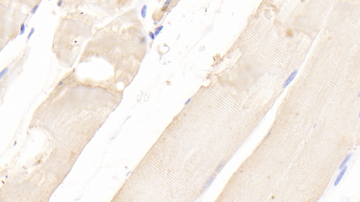 Polyclonal Antibody to Extracellular Signal Regulated Kinase 2 (ERK2)