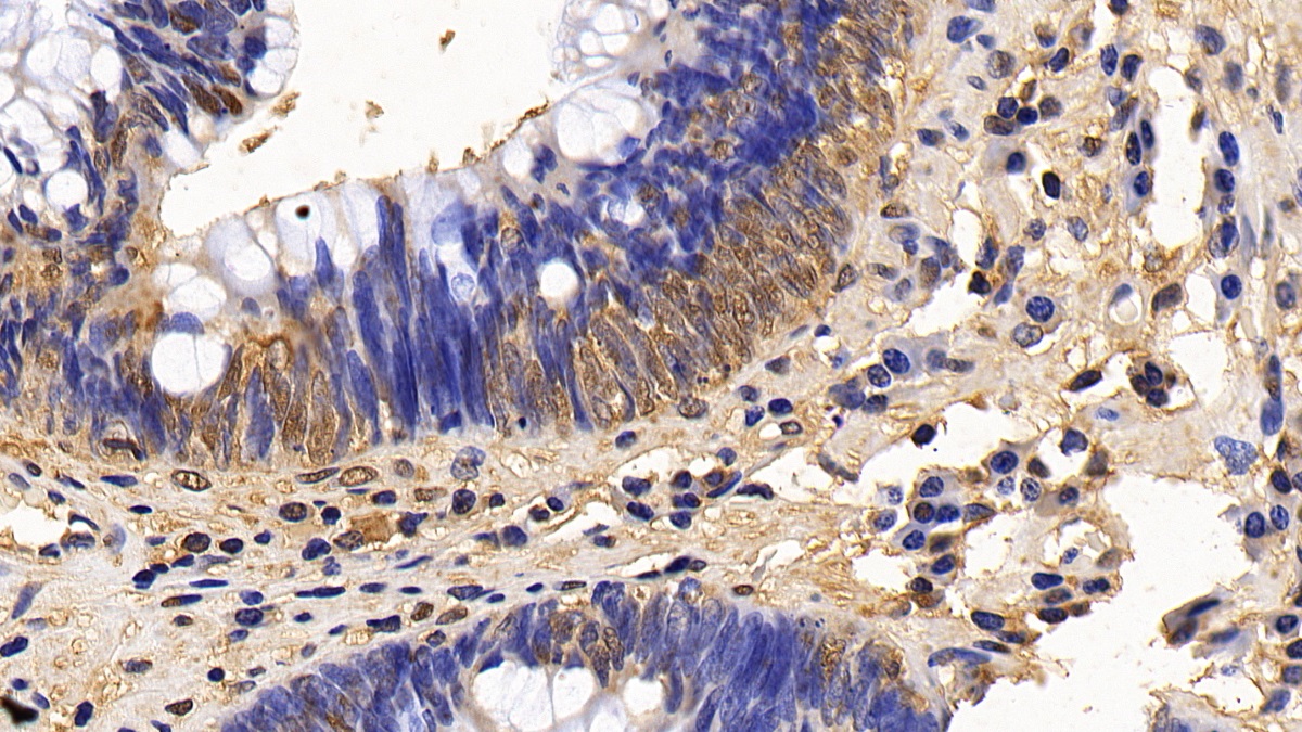 Polyclonal Antibody to Extracellular Signal Regulated Kinase 2 (ERK2)