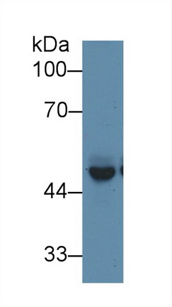 Polyclonal Antibody to Protein Interacting With C Kinase 1 (PICK1)