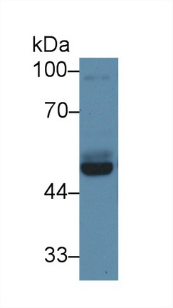 Polyclonal Antibody to Protein Interacting With C Kinase 1 (PICK1)