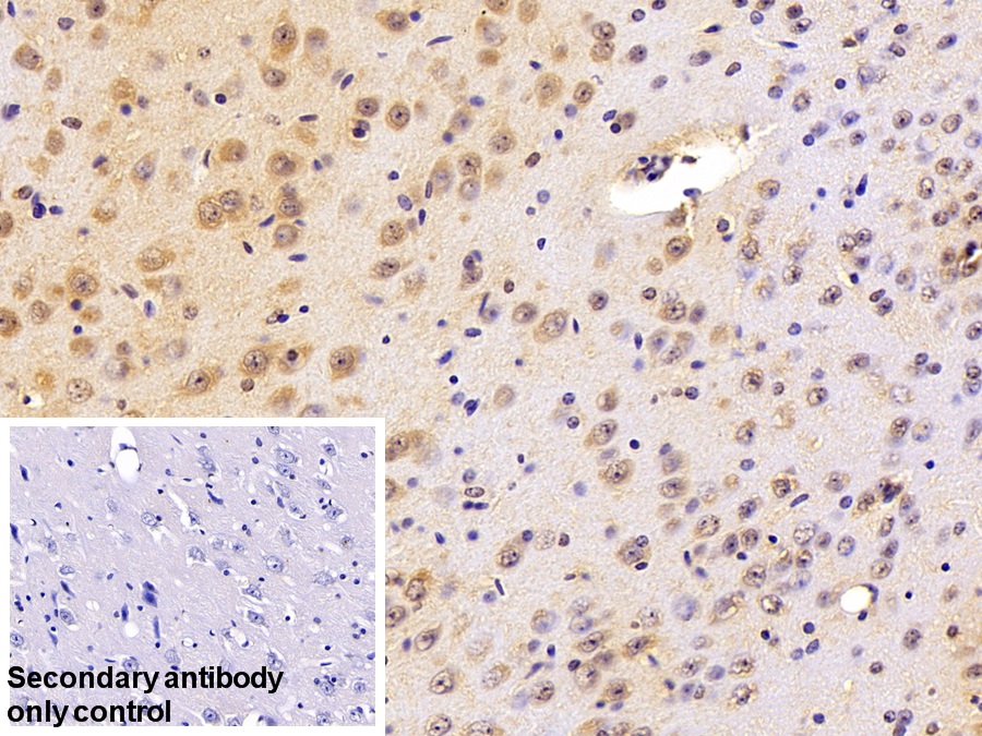 Polyclonal Antibody to Protein Interacting With C Kinase 1 (PICK1)