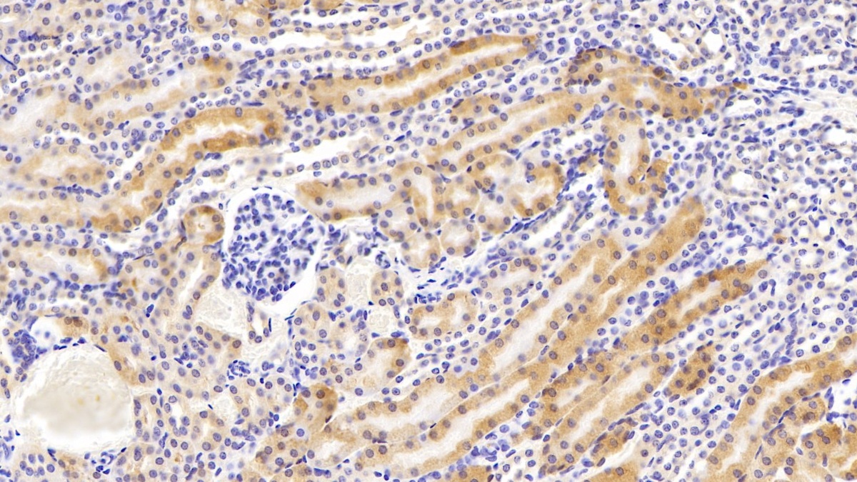 Polyclonal Antibody to Phosphoenolpyruvate Carboxykinase 1, Soluble (PCK1)