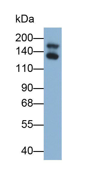 Polyclonal Antibody to Procollagen I N-Terminal Propeptide (PINP)