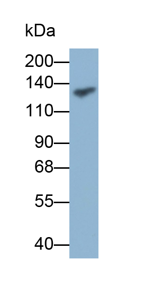 Polyclonal Antibody to Procollagen I N-Terminal Propeptide (PINP)