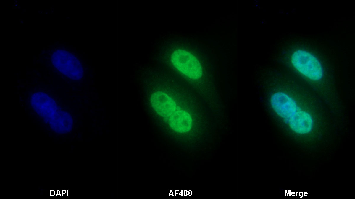 Polyclonal Antibody to Procollagen II C-Terminal Propeptide (PIICP)