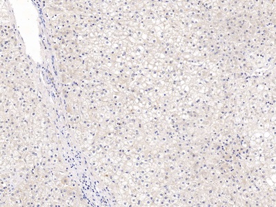 Polyclonal Antibody to Glypican 3 (GPC3)