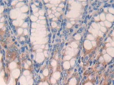 Polyclonal Antibody to Glypican 3 (GPC3)