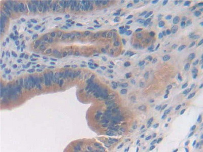 Polyclonal Antibody to Glypican 3 (GPC3)