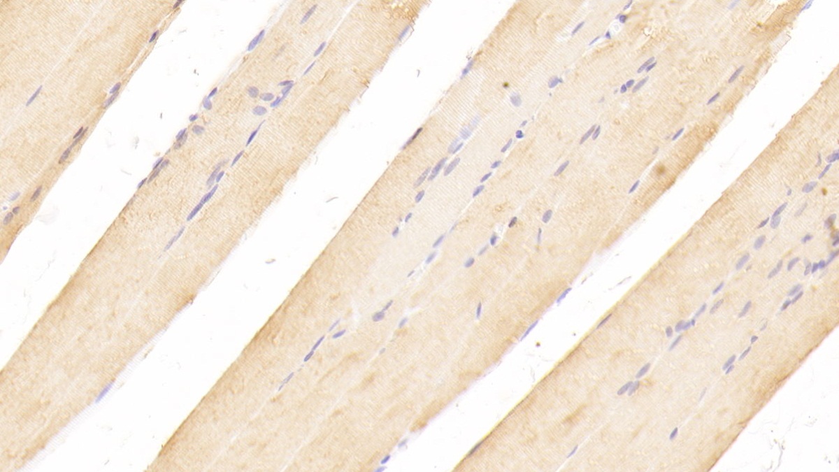 Polyclonal Antibody to Cholinergic Receptor, Nicotinic, Alpha 1 (CHRNa1)