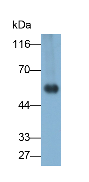 Polyclonal Antibody to Aldosterone Synthase (ALDOS)