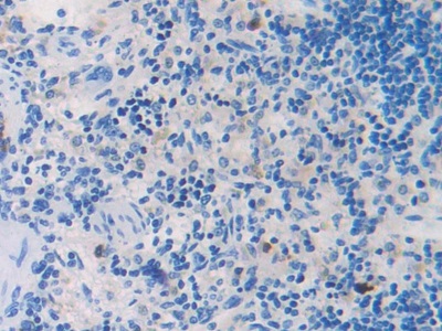 Polyclonal Antibody to Cytochrome P450 2E1 (CYP2E1)