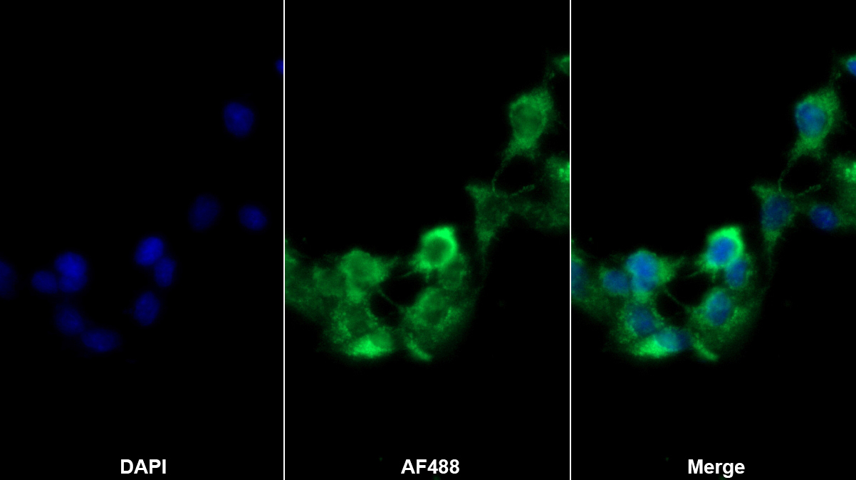 Polyclonal Antibody to Cytochrome P450 2E1 (CYP2E1)