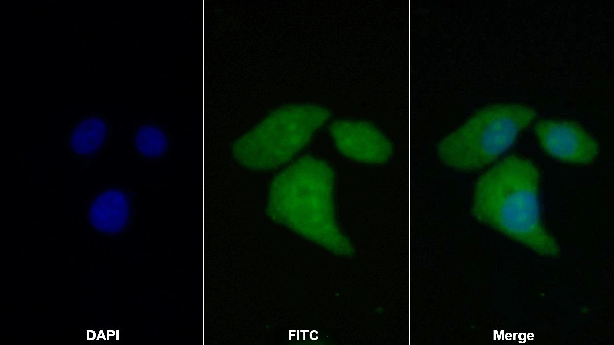 Polyclonal Antibody to Tubulin Polymerization Promoting Protein (TPPP)