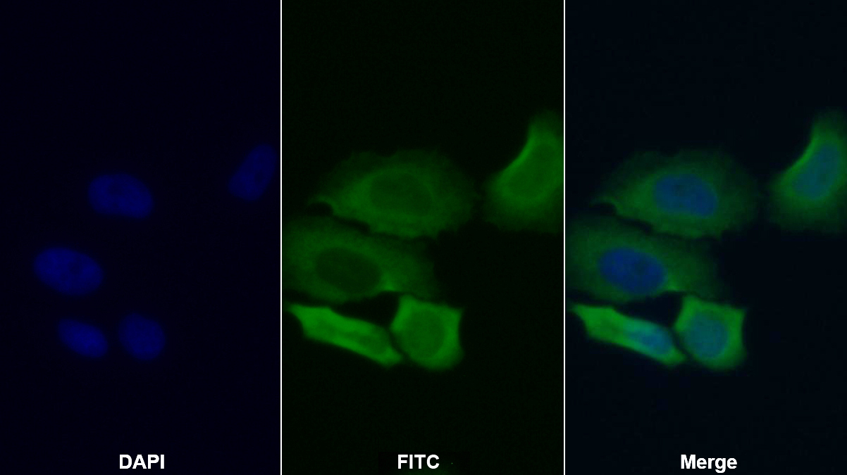 Polyclonal Antibody to Acid Phosphatase 1 (ACP1)