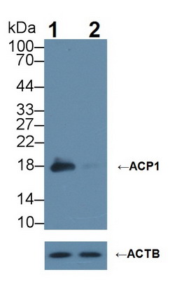 Polyclonal Antibody to Acid Phosphatase 1 (ACP1)