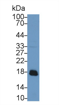 Polyclonal Antibody to Acid Phosphatase 1 (ACP1)