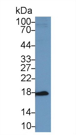 Polyclonal Antibody to Acid Phosphatase 1 (ACP1)