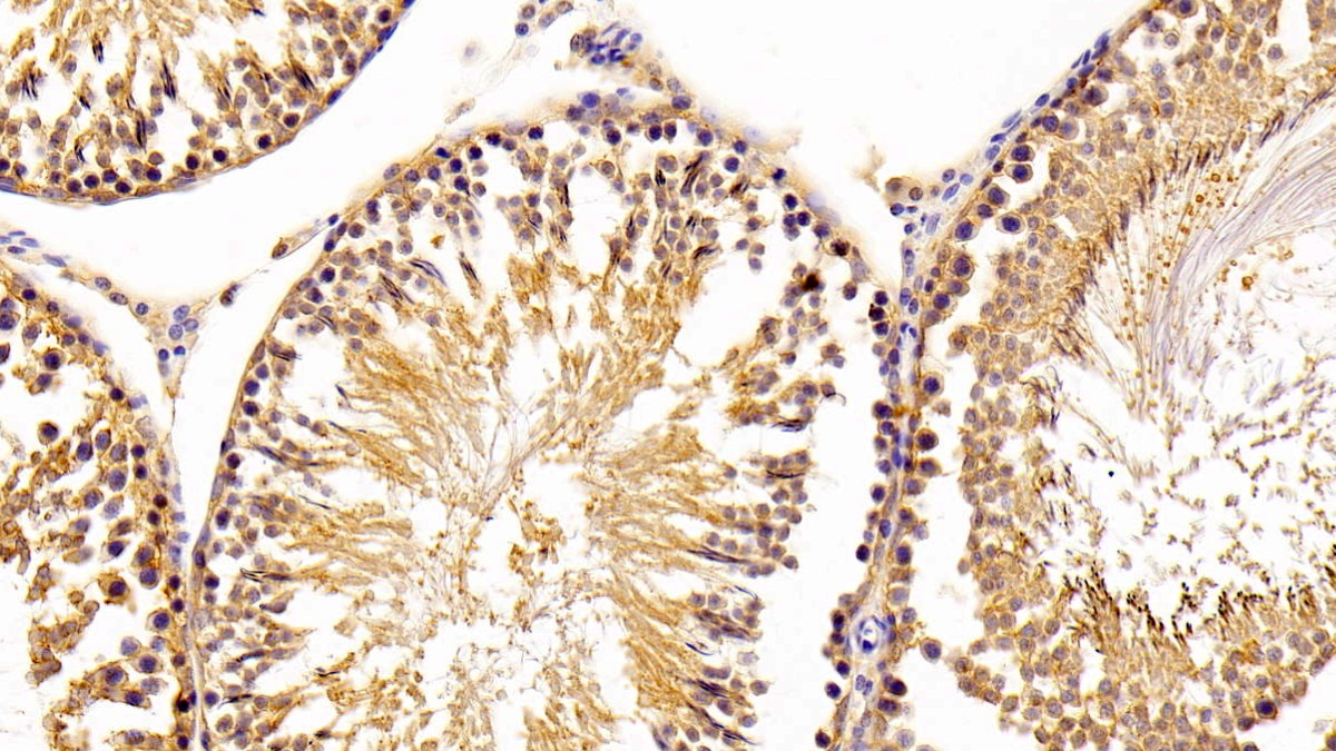 Polyclonal Antibody to Acid Phosphatase 1 (ACP1)