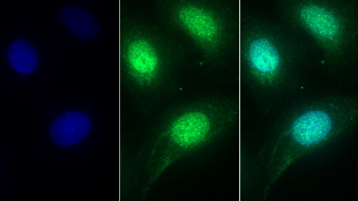 Polyclonal Antibody to Acid Phosphatase 1 (ACP1)