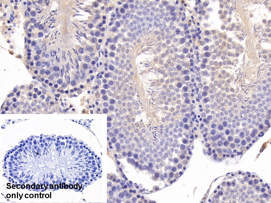 Polyclonal Antibody to Acid Phosphatase 1 (ACP1)