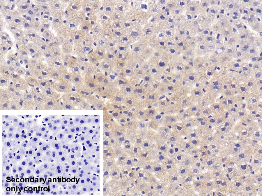 Polyclonal Antibody to Acid Phosphatase 1 (ACP1)