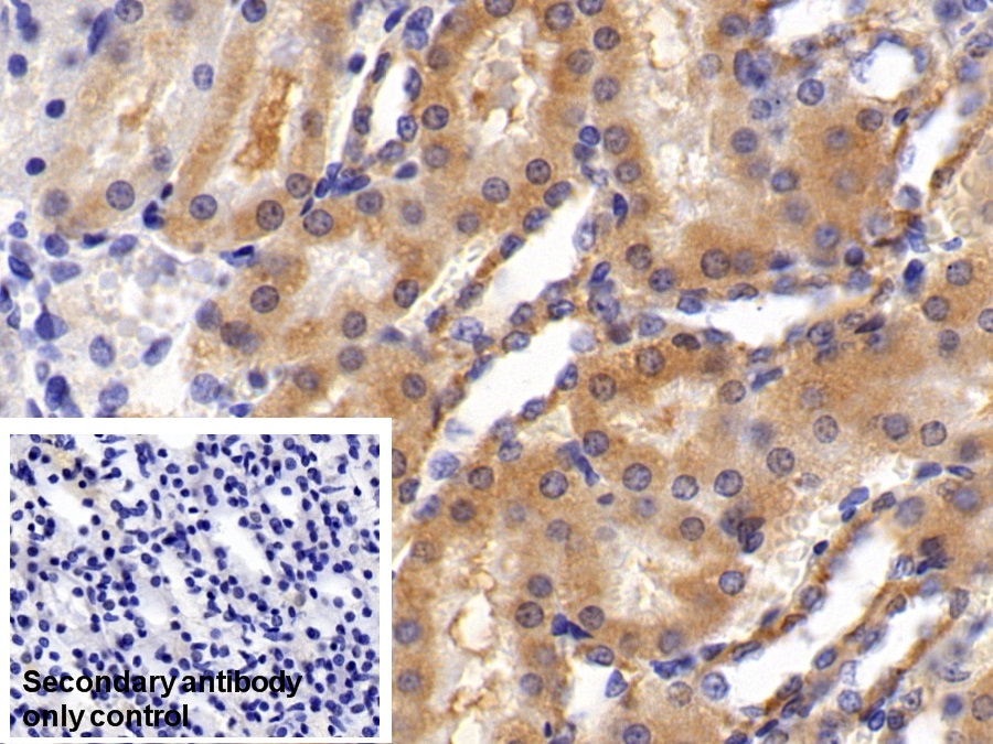 Polyclonal Antibody to Acid Phosphatase 1 (ACP1)