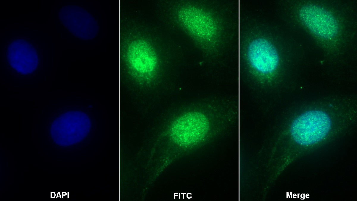 Polyclonal Antibody to Acid Phosphatase 1 (ACP1)