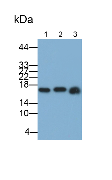 Polyclonal Antibody to Acid Phosphatase 1 (ACP1)