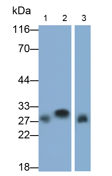 Polyclonal Antibody to High Density Lipoprotein (HDL)