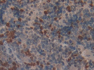 Polyclonal Antibody to Low Density Lipoprotein Receptor (LDLR)