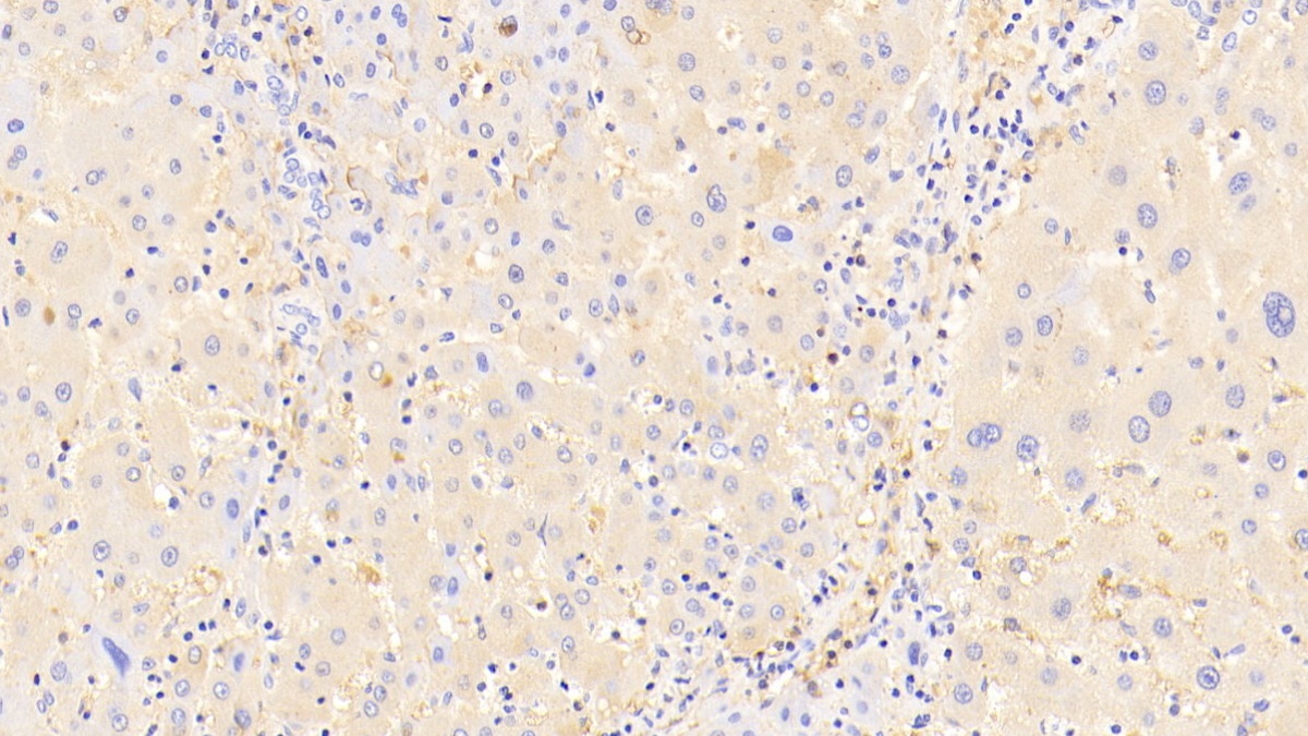 Polyclonal Antibody to Alpha-2-Macroglobulin (a2M)