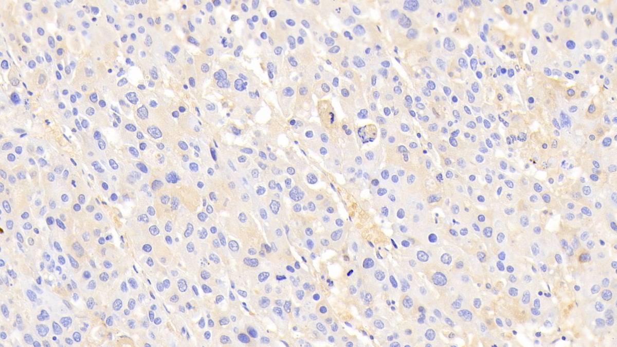 Polyclonal Antibody to Alpha-2-Macroglobulin (a2M)
