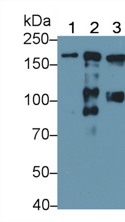 Polyclonal Antibody to Alpha-2-Macroglobulin (a2M)