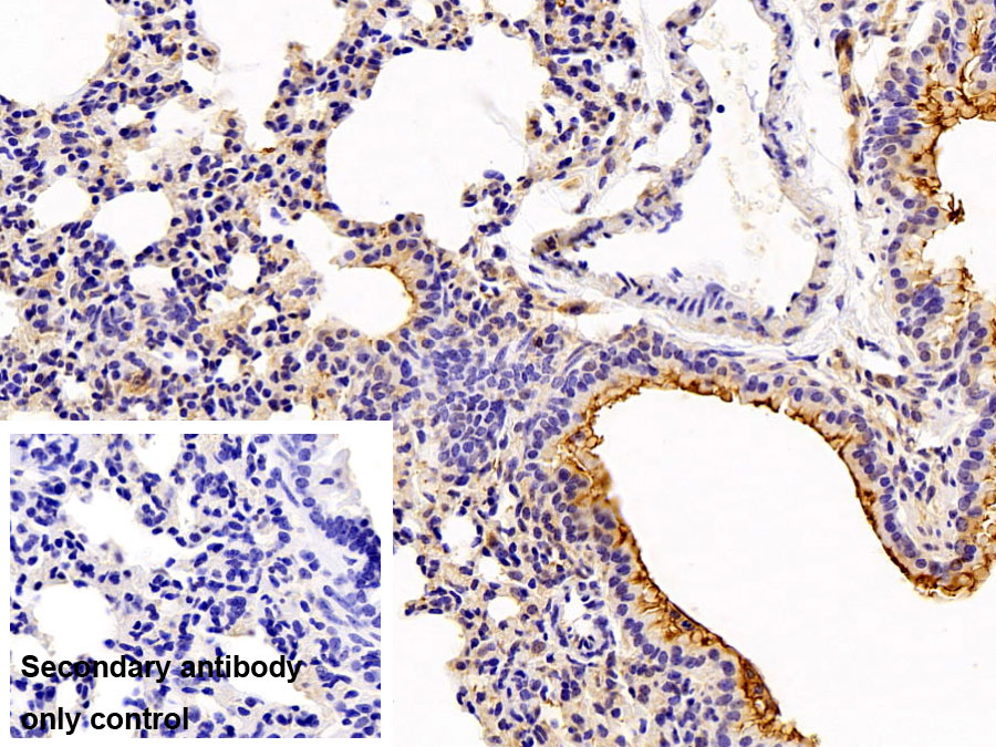 Polyclonal Antibody to Beta Catenin (β-catenin)