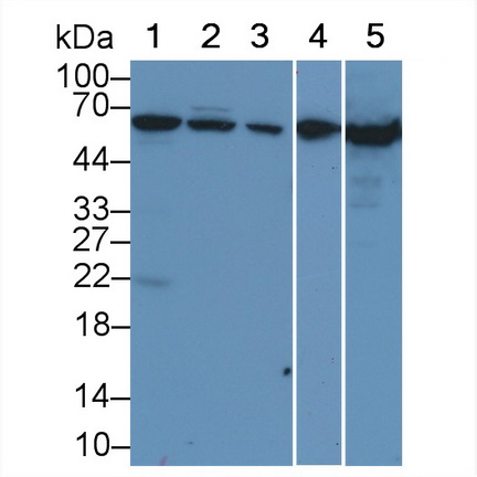 Polyclonal Antibody to Albumin (ALB)