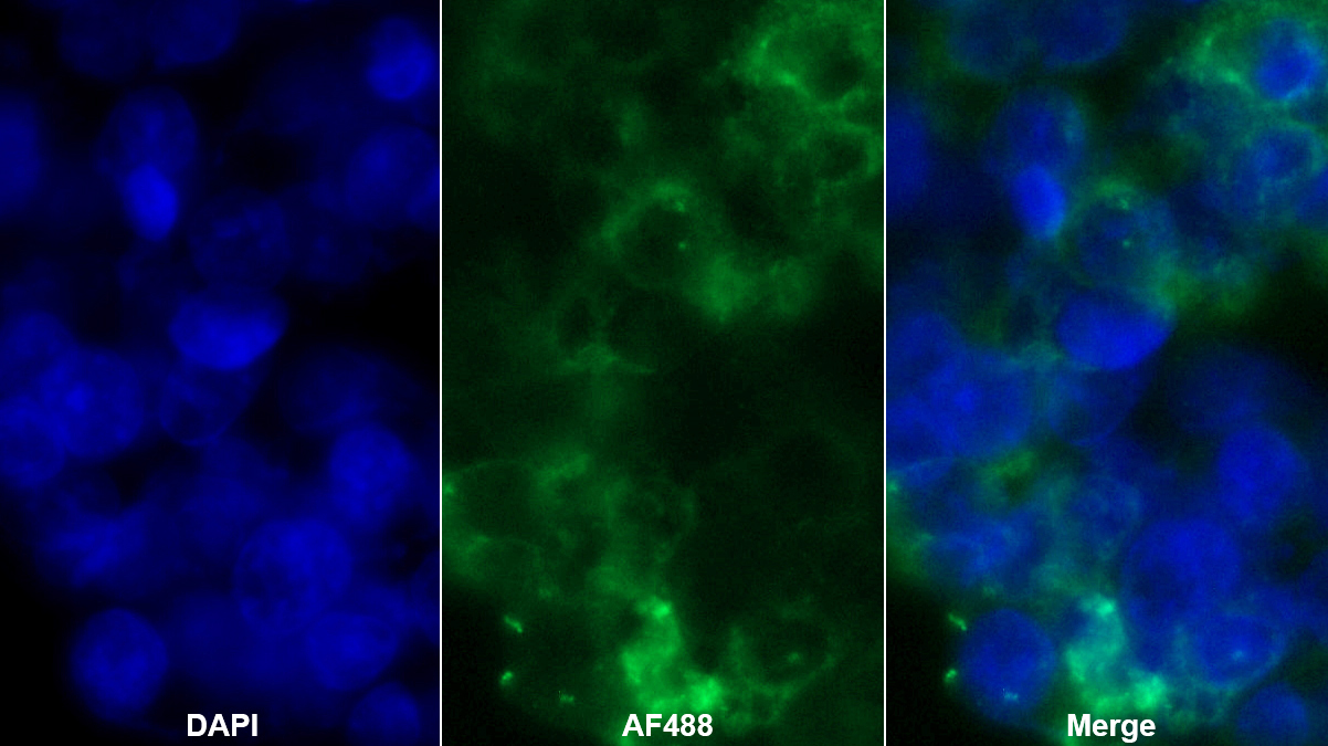 Polyclonal Antibody to Albumin (ALB)